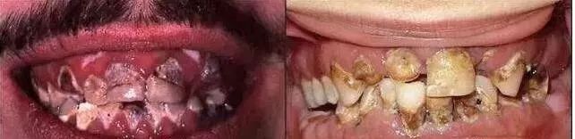 禁毒知识毒品的危害答案,禁毒知识资料毒品的危害