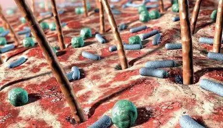 洗衣机用啥消毒去除传染病,洗衣机怎么消毒不会感染疾病