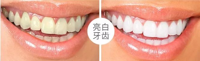 黄牙口臭的克星,牙黄口臭用什么牙膏有效果一点