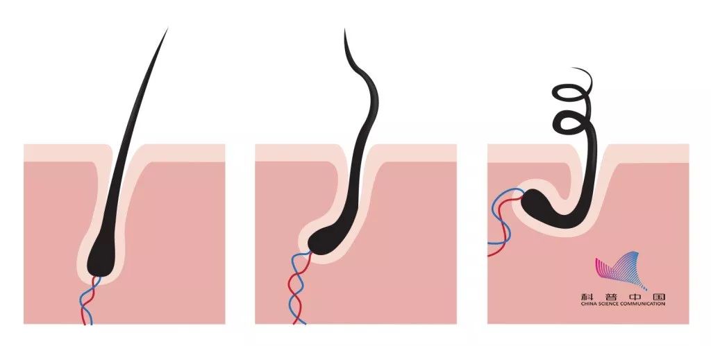 每天差不多掉多少头发算脱发,一天掉多少根头发算脱发
