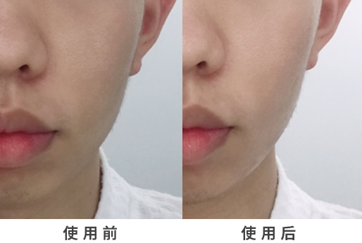 熬夜急救法,熬夜到天亮怎么急救