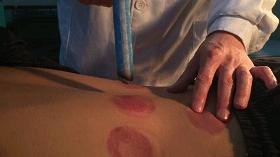 「传统医药日」秋冬预防季节性疾病，巧用艾条“自灸”益处多