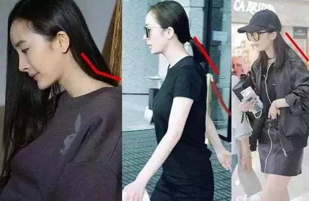 防驼背矫正神器步骤,纠正驼背神器视频