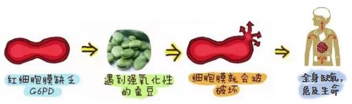 什么血液病不能吃蚕豆,血液病吃蚕豆