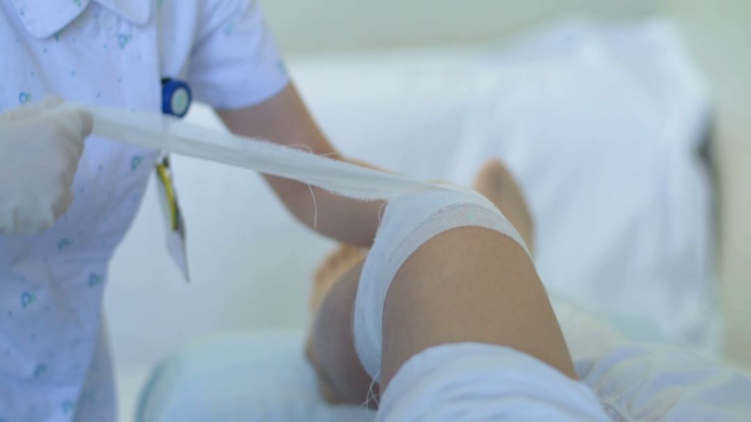 宝宝15个月o型腿最快变直的方法,内旋型o型腿与外旋型o型腿的区别