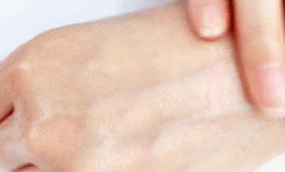 适合黄皮干皮用的面膜,黄皮黑皮适合用的面膜