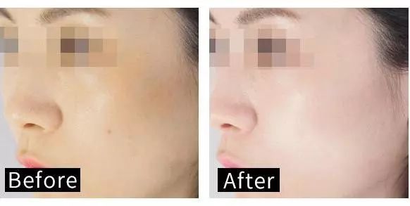 我强烈推荐这款面膜英文,适合黄皮用的美白面膜