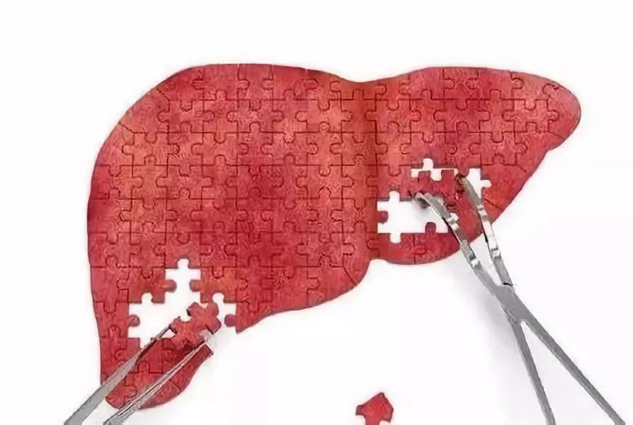 转氨酶升高要保肝治疗吗,抗病毒治疗转氨酶反而升高