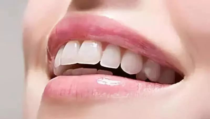 十大美白牙齿牙膏,美白去渍牙膏澳洲