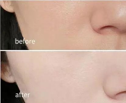 油腻泛红毛孔粗大用什么面膜,油腻暗沉皮肤用什么护肤品好