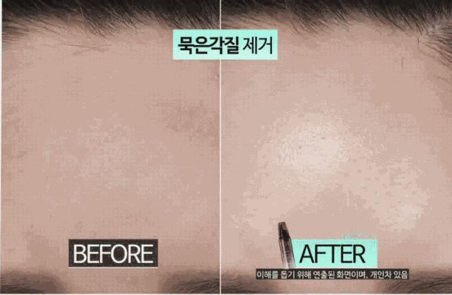 去黑头去角质慕斯,3分钟祛除黑头