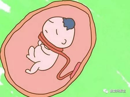 脐带绕颈三圈预示什么,脐带绕颈妈妈要怎么睡宝宝才舒服