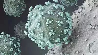 80岁老人查出梅毒是什么原因,男子体检查出梅毒原因让人震惊了