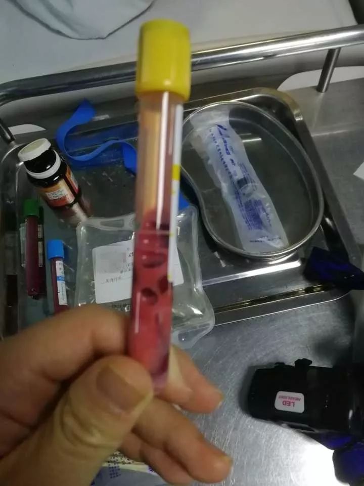 17岁少女抽出粉红色的血,瞬间凝固差点丢命!原因竟是3年前开始……