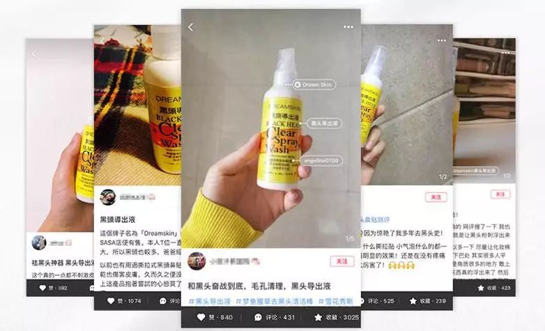 去多年顽固黑头,长了一年的黑头怎么去除