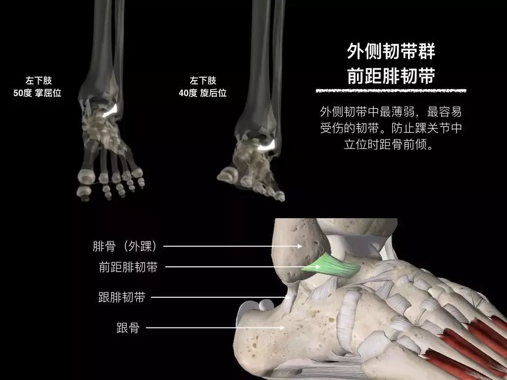 踝关节韧带核磁断层解剖图,踝关节外侧副韧带的功能解剖