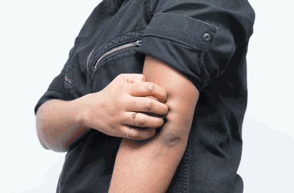 冬季吃什么让皮肤不干燥,这个冬天让你的皮肤不干燥