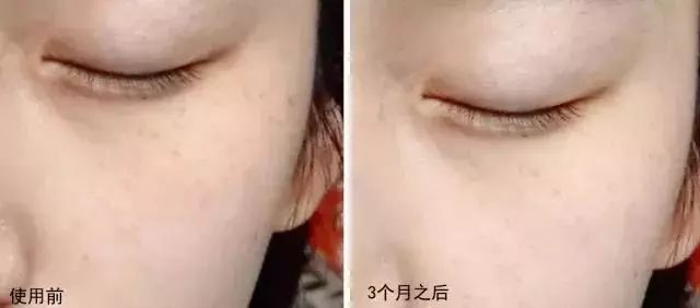 女生来大姨妈痛经喝什么能缓解,来大姨妈缓解痛经的药