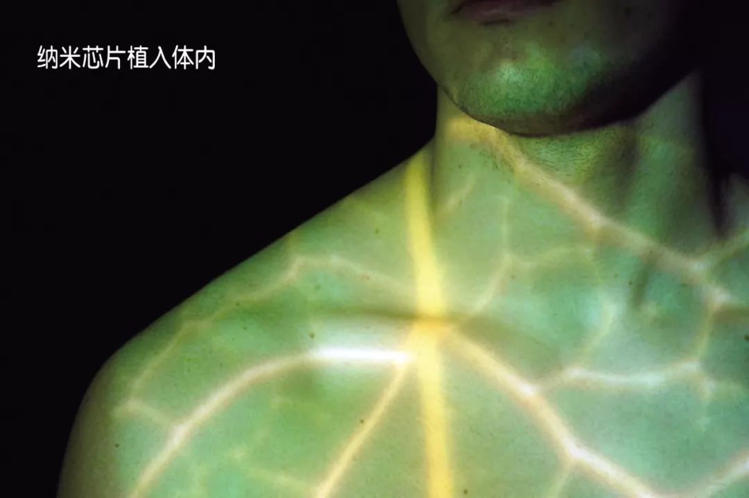 光动力可以杀死hpv吗,光动力治疗能杀死肺癌肿瘤吗