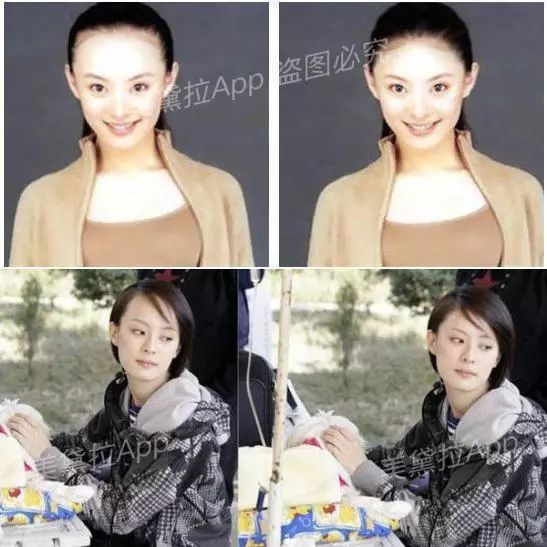 头等大事脱发青年自救指南,秃头女孩必看6大脱发误区