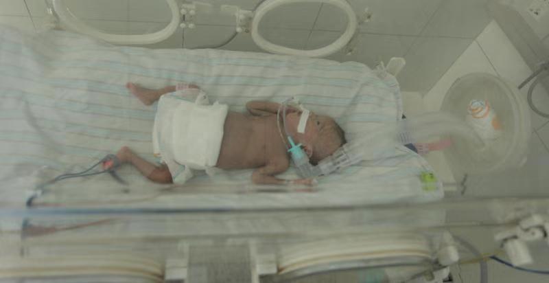 “巴掌宝宝”出院了,湖南“巴掌宝宝”已出院