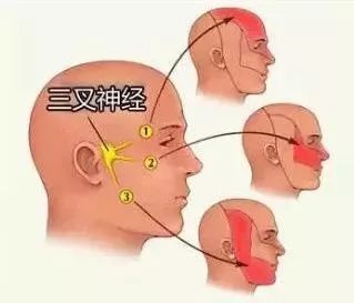 牙疼下巴疼脸也疼是三叉神经疼吗,牙疼三叉神经痛的最佳解决办法