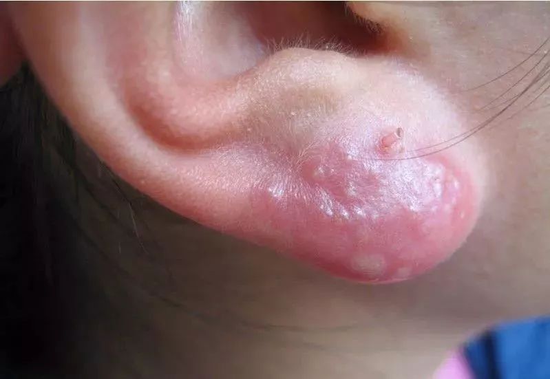 杏林医院皮肤科,杏林皮肤科医院