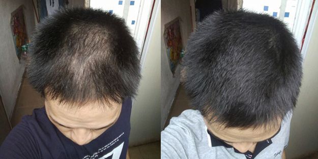 额前长小碎发,额前小碎发往后长