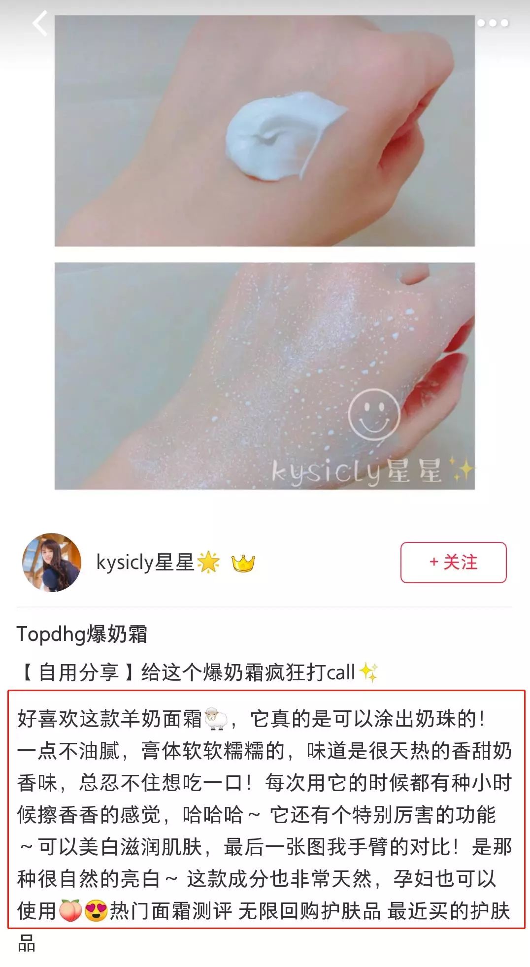 脱发算啥！90后已经开始长“老年斑”了，有人还为此花了10多万！