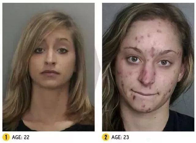 吸毒者最明显的特征是什么,吸毒的人最明显的特征是什么