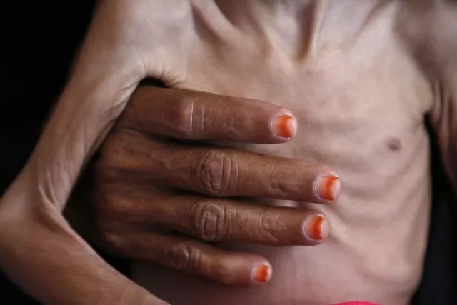 这就是中国2018年,2018新华社国际年度照片