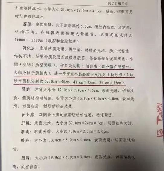 女子术后纱布留体内腹痛死亡,女子引产纱布留体内