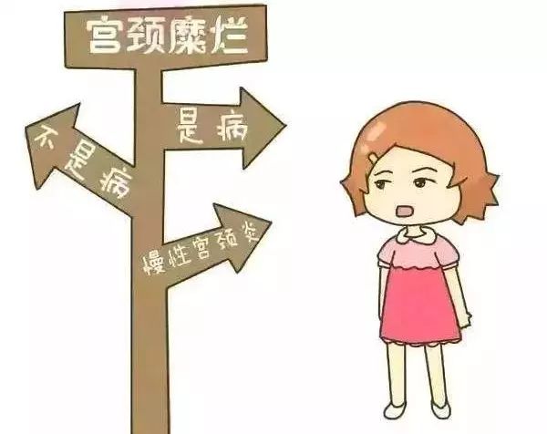 宫颈糜烂到底要不要做激光手术,宫颈糜烂到底要不要做手术