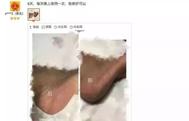 脚后跟干裂修复霜去死皮,脚干裂脱皮修复霜