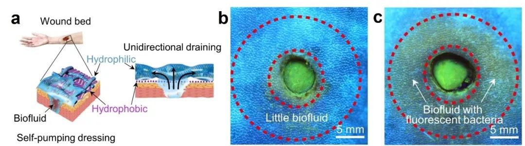 水泥堵鼻子创可贴,创可贴可常贴吗