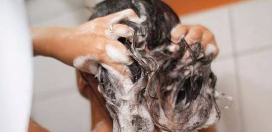 头皮屑洗不掉怎么办有什么方法,头发头皮屑多且大块还结痂有虫