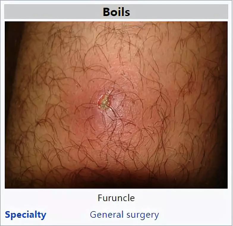 体温计最高温度为什么是42,体温计刻度只有42c正常吗