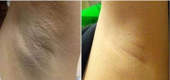 日本口碑爆棚的美白皂，洗完连手肘腋下都变粉嫩了！