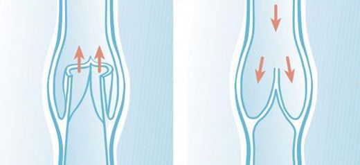 刺血后刺血地方胀痛是什么原因,刺血疗法出不来血是什么原因