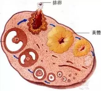 腹腔出血黄体破裂,黄体破裂腹腔有血