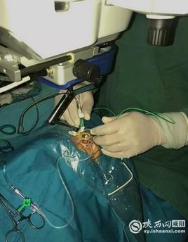 咸阳第一人民医院眼睛手术,咸阳市第一人民医院眼科飞秒手术