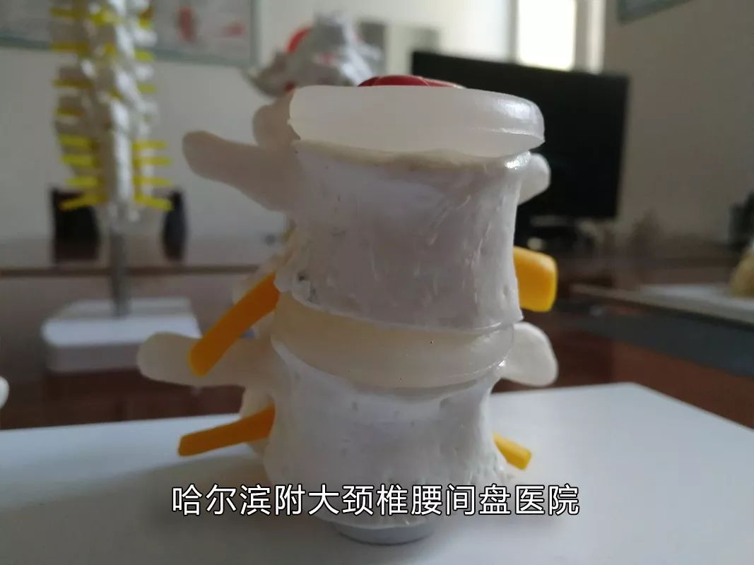 你家睡啥床?你常玩手机?腰痛难忍反复发作、久治不愈,腰间的不能承受之痛该如何缓解?