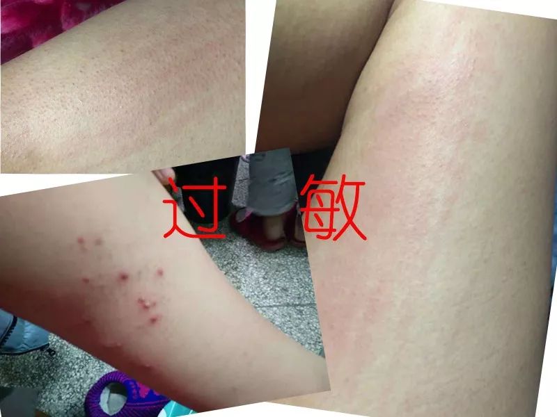 经络刷瘦身教程,经络刷减肥瘦肚子按摩手法