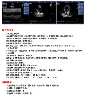心衰治疗金三角,心衰的金三角治疗是指什么