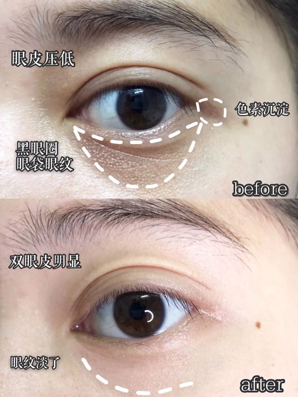 韩国牌子眼霜抗老去皱保湿,韩国平价眼霜精华全脸用的