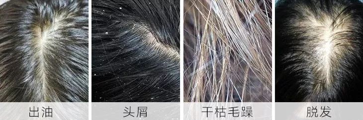 真正好用的洗发神器,一款超级好用的洗头神器