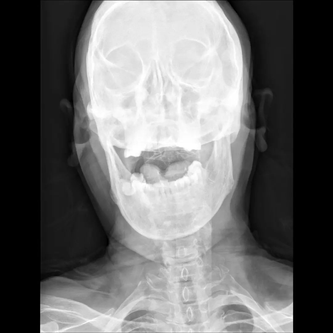 鍕囬棷鐢熷懡绂佸尯鍖婚櫌,鍕囬棷鐢熷懡绂佸尯浜旀鍙仠鎵嬫湳