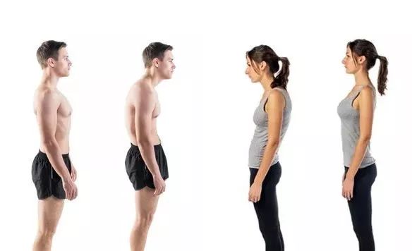 明星颈前倾的矫正方法,脖子前倾的明星有哪些