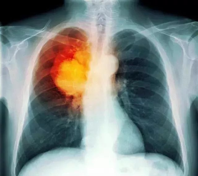 一人吸烟毁三代！抽烟的危害，比你想象的更大