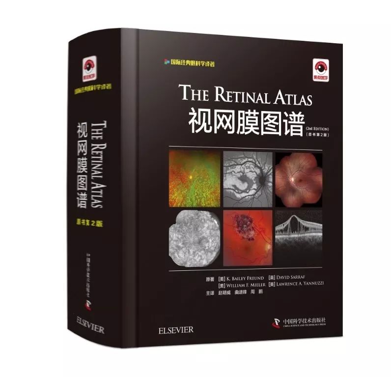 眼底病变眼睛图片,眼底病变的高清挂图